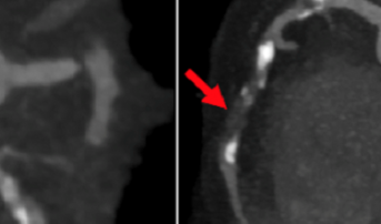 For Cardiac CT, COVID-19 Has Toppled Silos and Paved the Way for Change